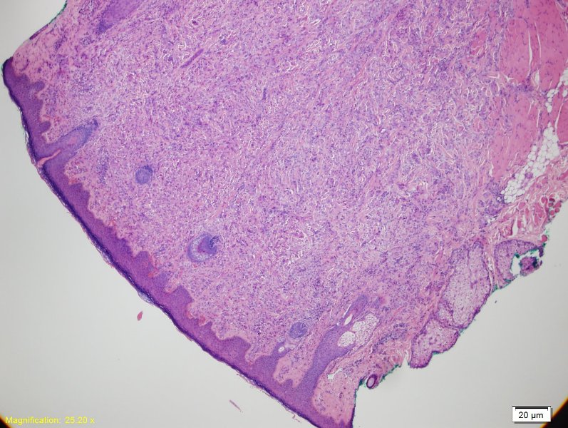 Pathology Image